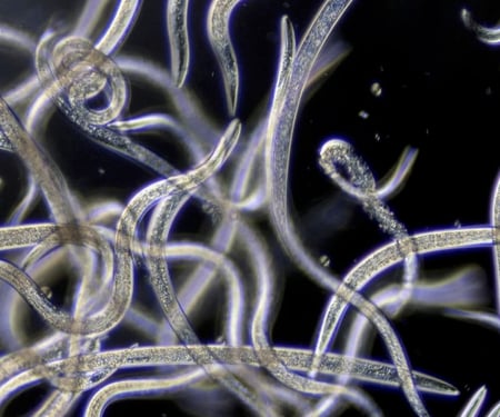 Beneficial nematodes used for grub treatments as seen under a microscope